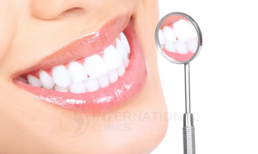 491096b47d97a6a937c6e5bcc9597799 سفید کردن دندان با لیزر در ترکیه