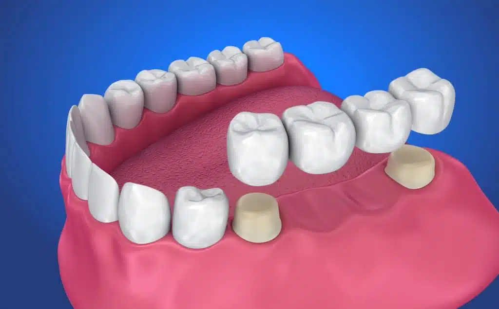 8bc817179fa596721d0f691b5ec39b8c علاج الأسنان في تركيا