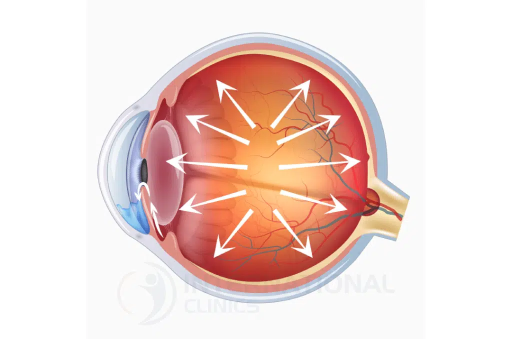 what is normal ocular pressure