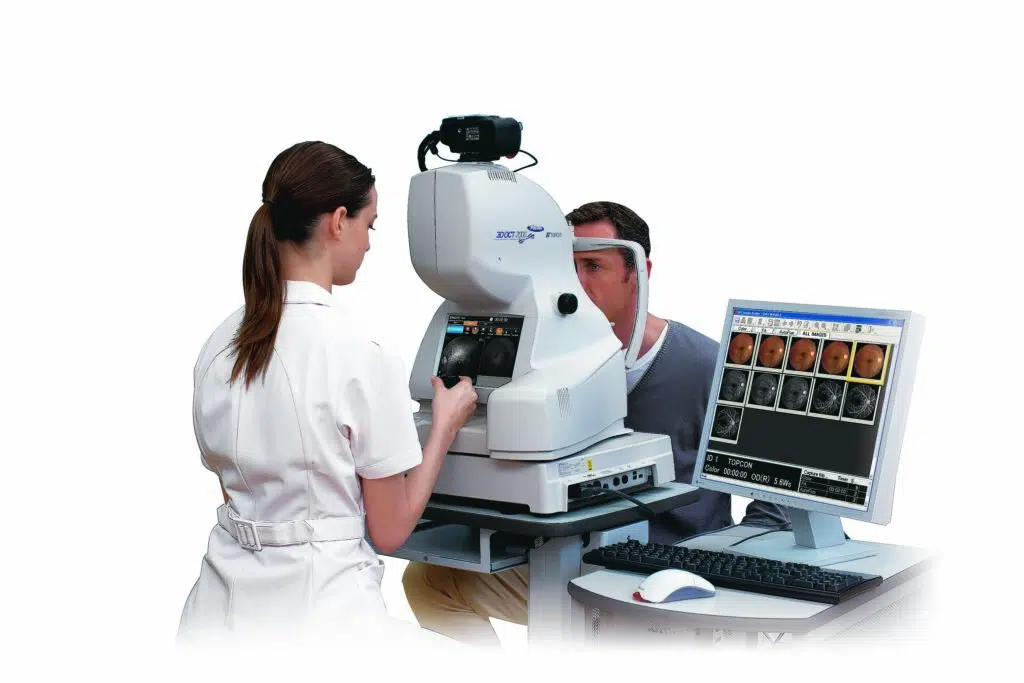 stratus optical coherence tomography Protocols