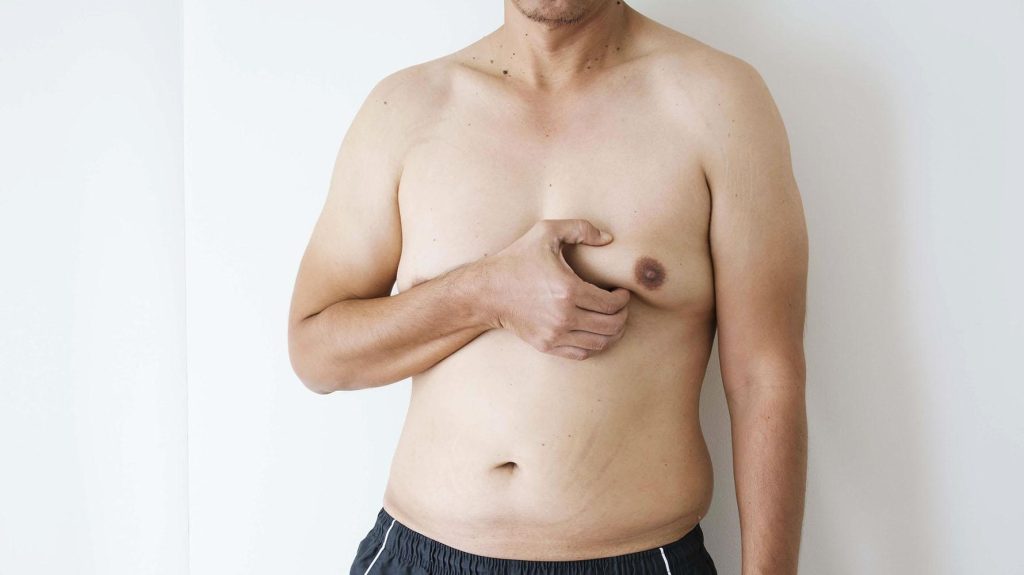 جراحی کوچک کردن سینه در مردان