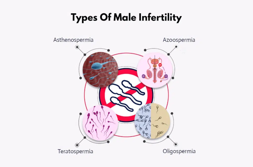 types of male Infertility