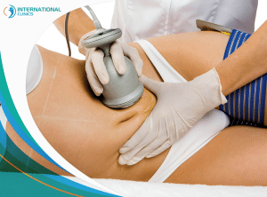Water Assisted Liposuction