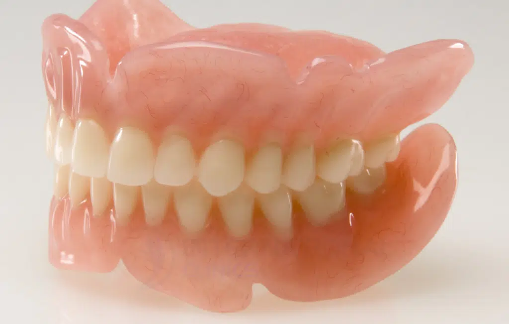 طقم الاسنان - التعويضات المتحركة