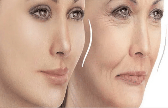 حقن الدهون الذاتية في الوجه