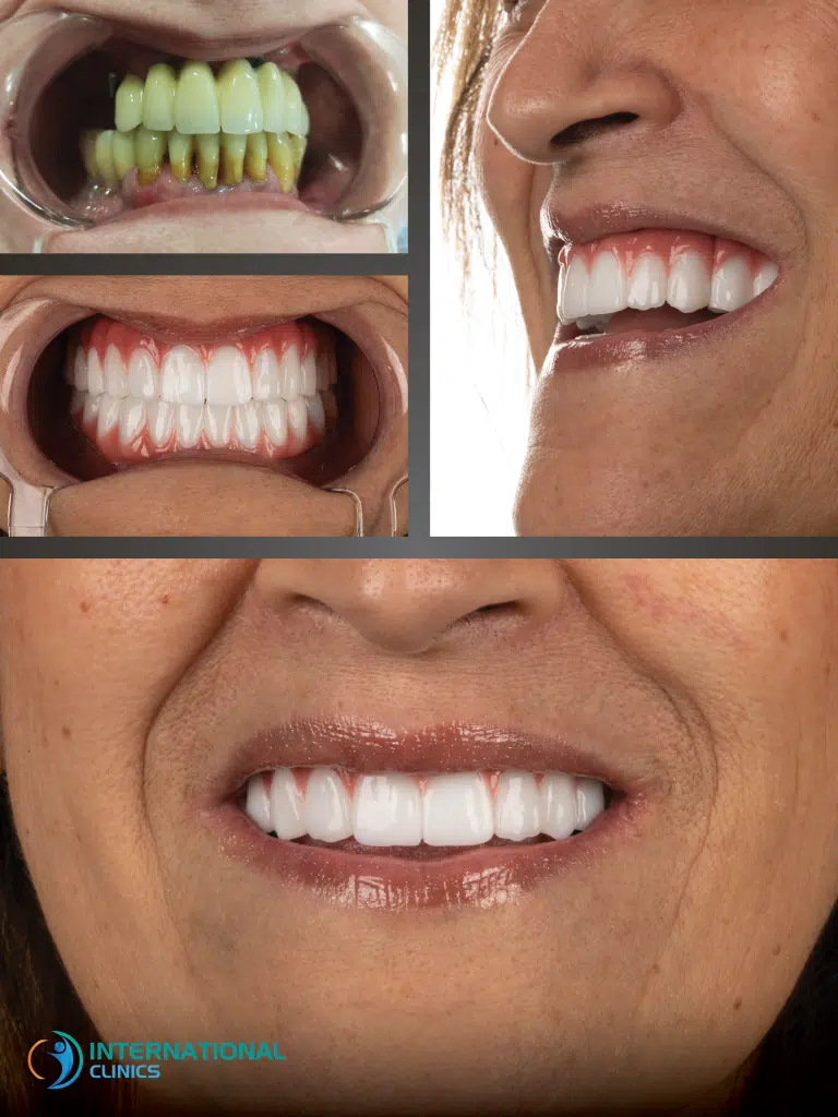 cosmetic dentistry before and after image