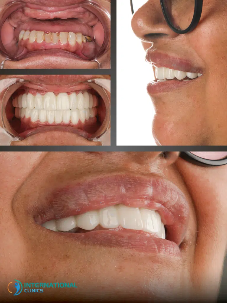 Cosmetic Dentistry Before and After picture
