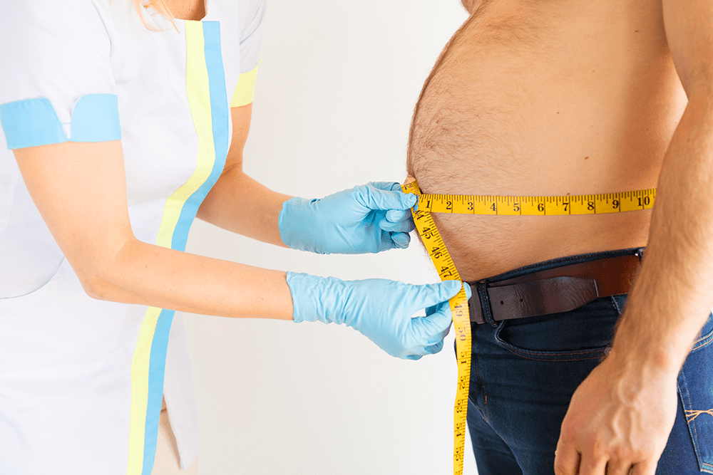 Candidates for Gastric Sleeve in Turkey