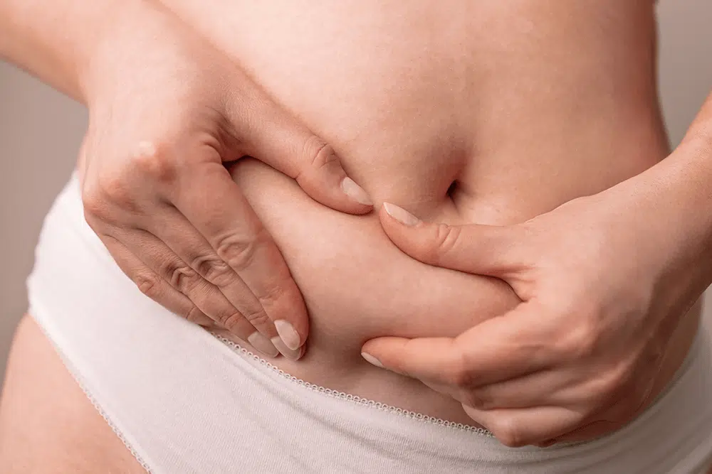 الحمل بعد شفط الدهون