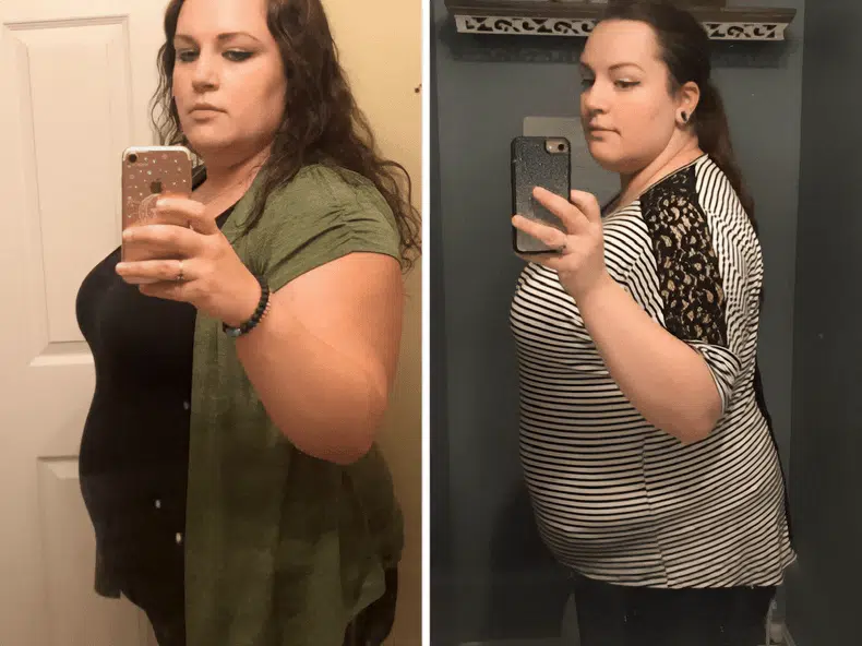 Gastric Sleeve Before and After 3 Months image