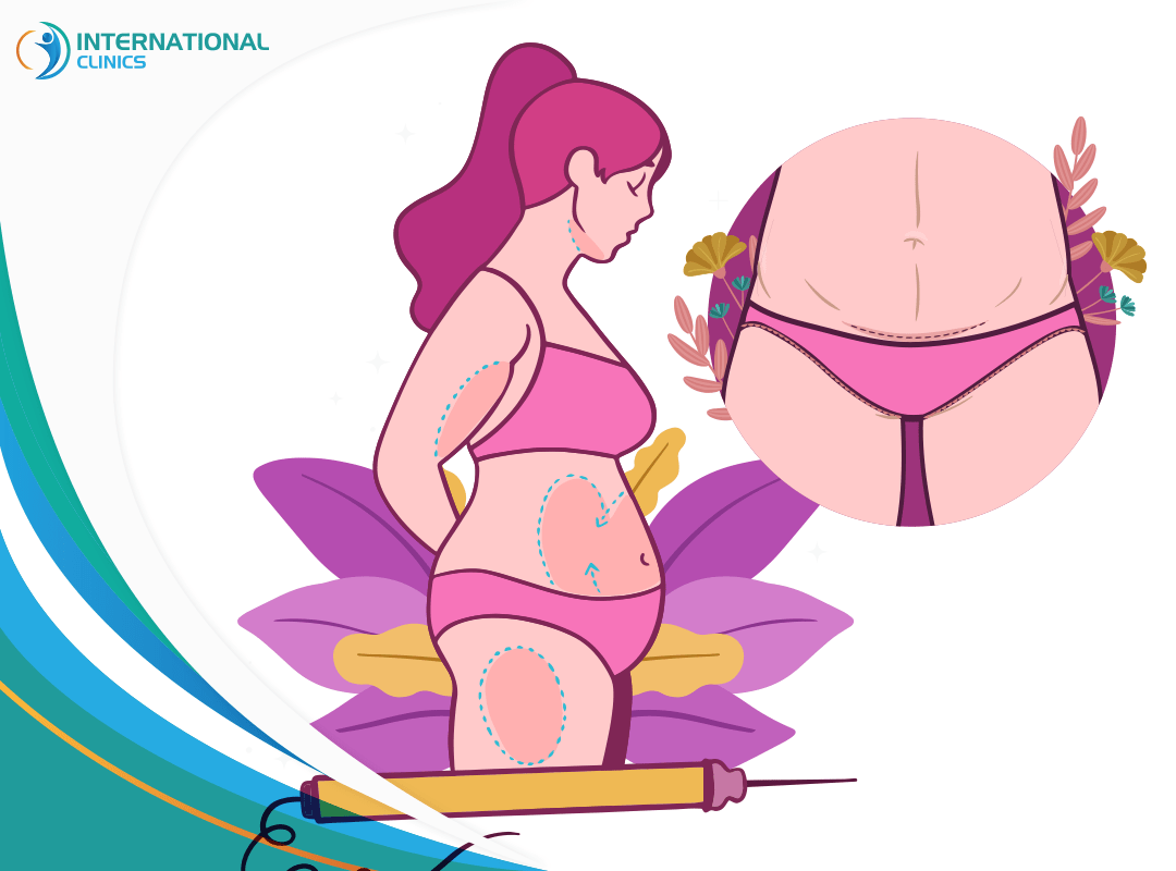 Tummy Tuck vs Liposuction: Understanding the Key Differences