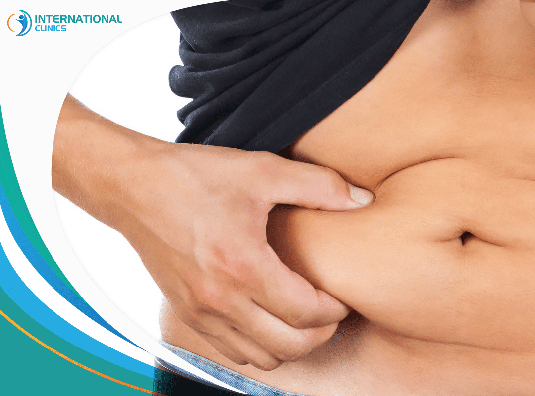 All about stomach liposuction for a perfectly sculpted abdomen