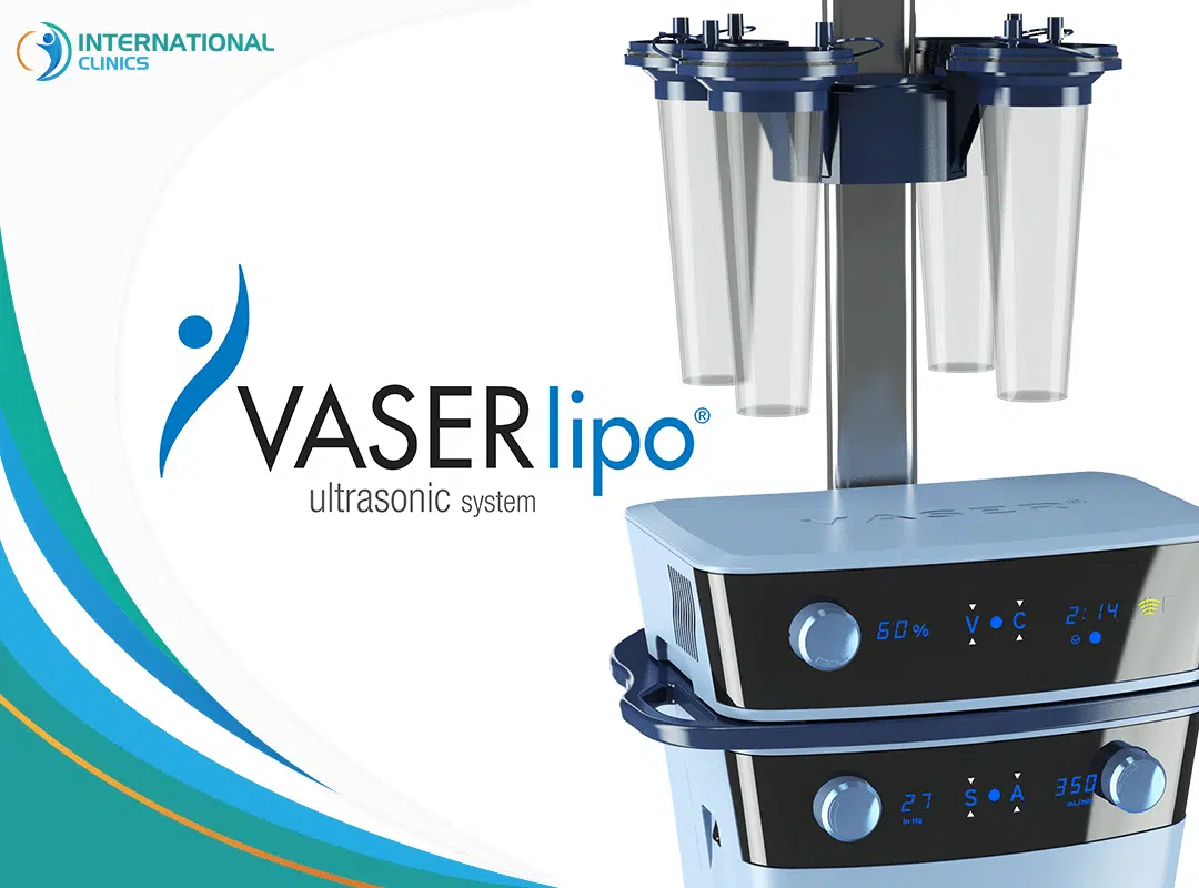 What is Vaser Liposuction? Sculpting Your Ideal Look