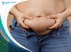 ffdb9c7b588a5198bd826439cabeb0f9 What to expect 3 weeks after liposuction?