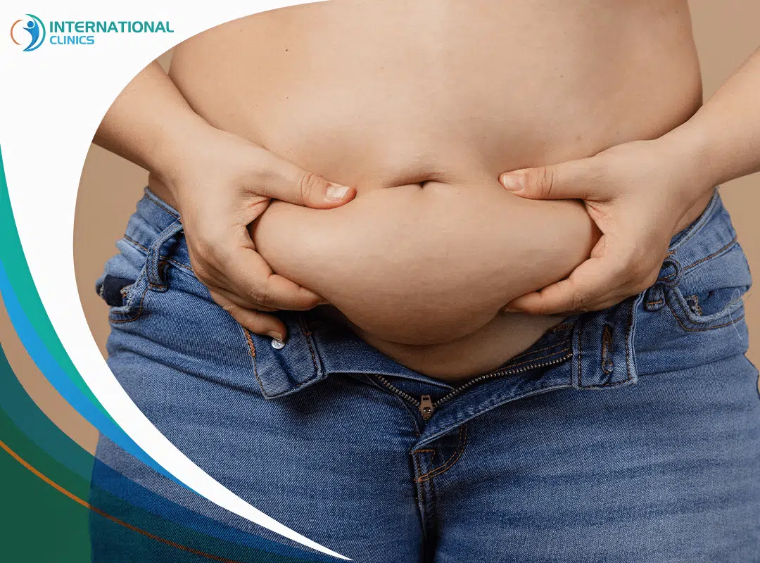 How Is Liposuction Done?
