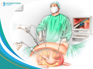 409034496a9363e4602f67835eb3228f Gastric Sleeve Surgery Cost,Gastric Sleeve Surgery price