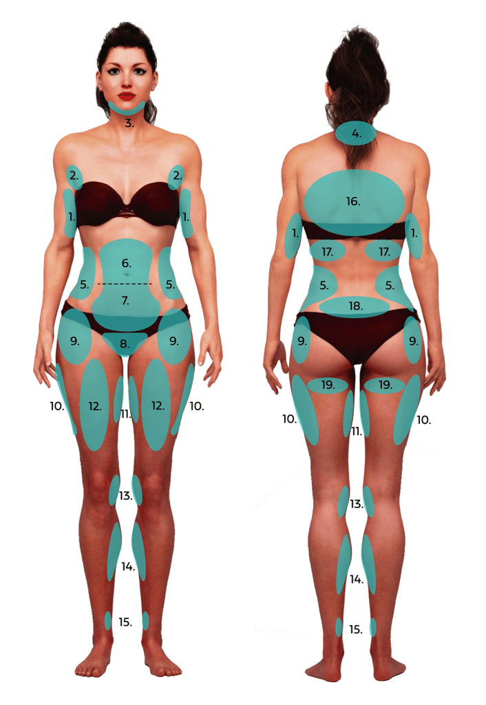 detailed list of Liposuction Areas 