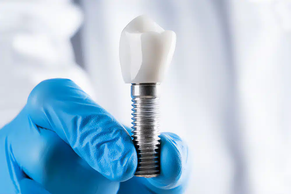 Precios de implantes dentales en Turquía