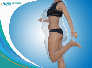 6d97898425acb82f13fff2f1ca78d0f4 What to expect 3 weeks after liposuction?