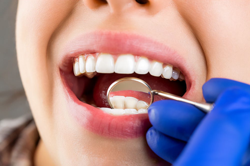 Precios de implantes dentales en Turquía
