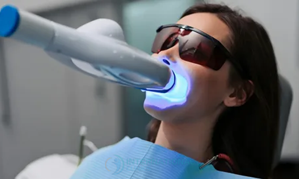 بدائل ابتسامة هوليوود