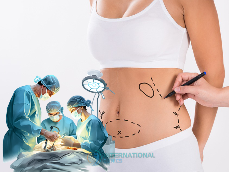 435cfb7779dc5d35a32190cb264162db Gastric Bypass Surgery Cost in Turkey,Gastric Bypass Cost in Turkey