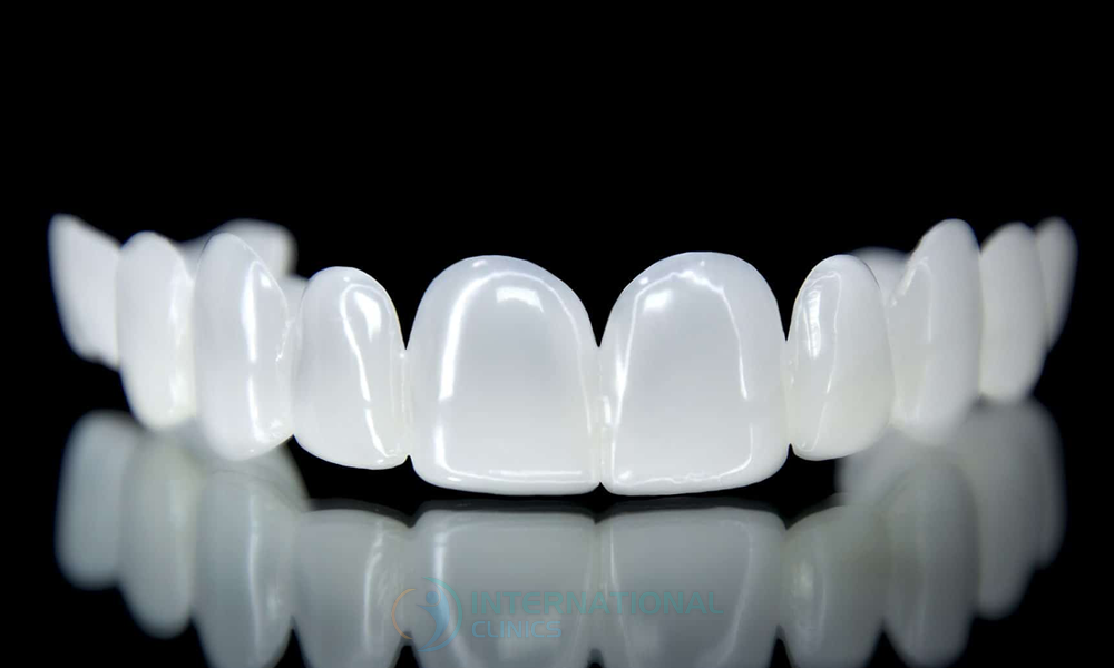 بدائل ابتسامة هوليوود