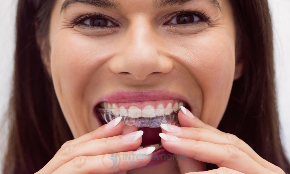 بدائل ابتسامة هوليوود