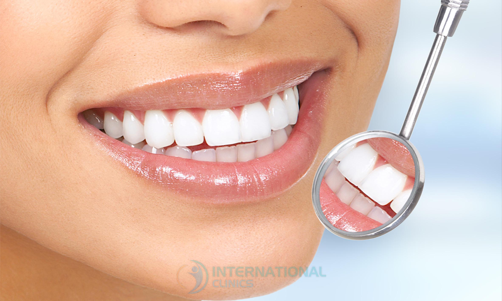 بدائل ابتسامة هوليوود